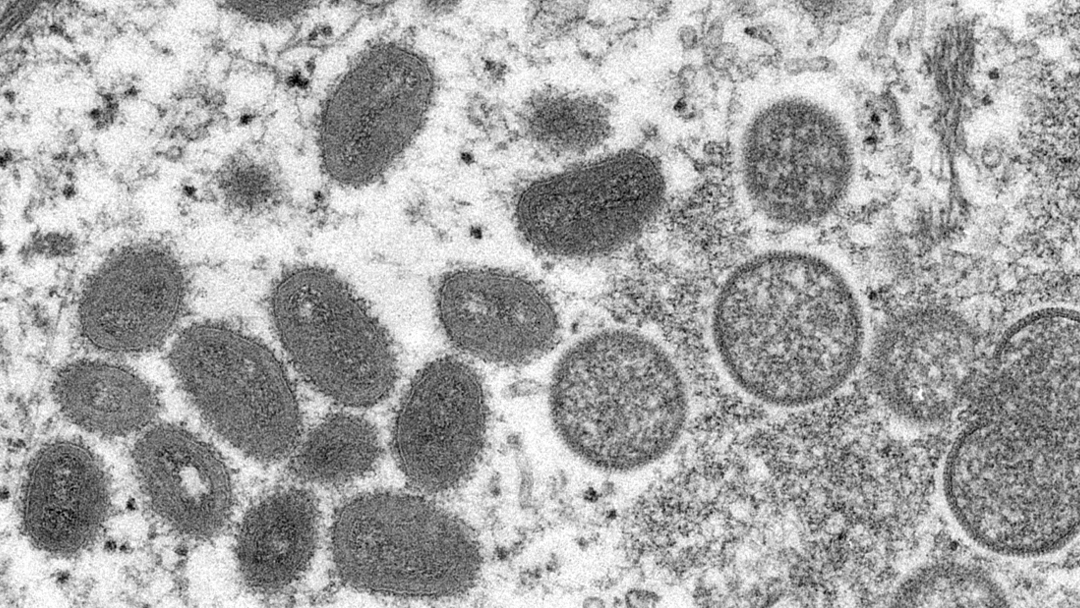 WHO declares Monkeypox as a Global Public Health emergency; Here’s what you need to know.